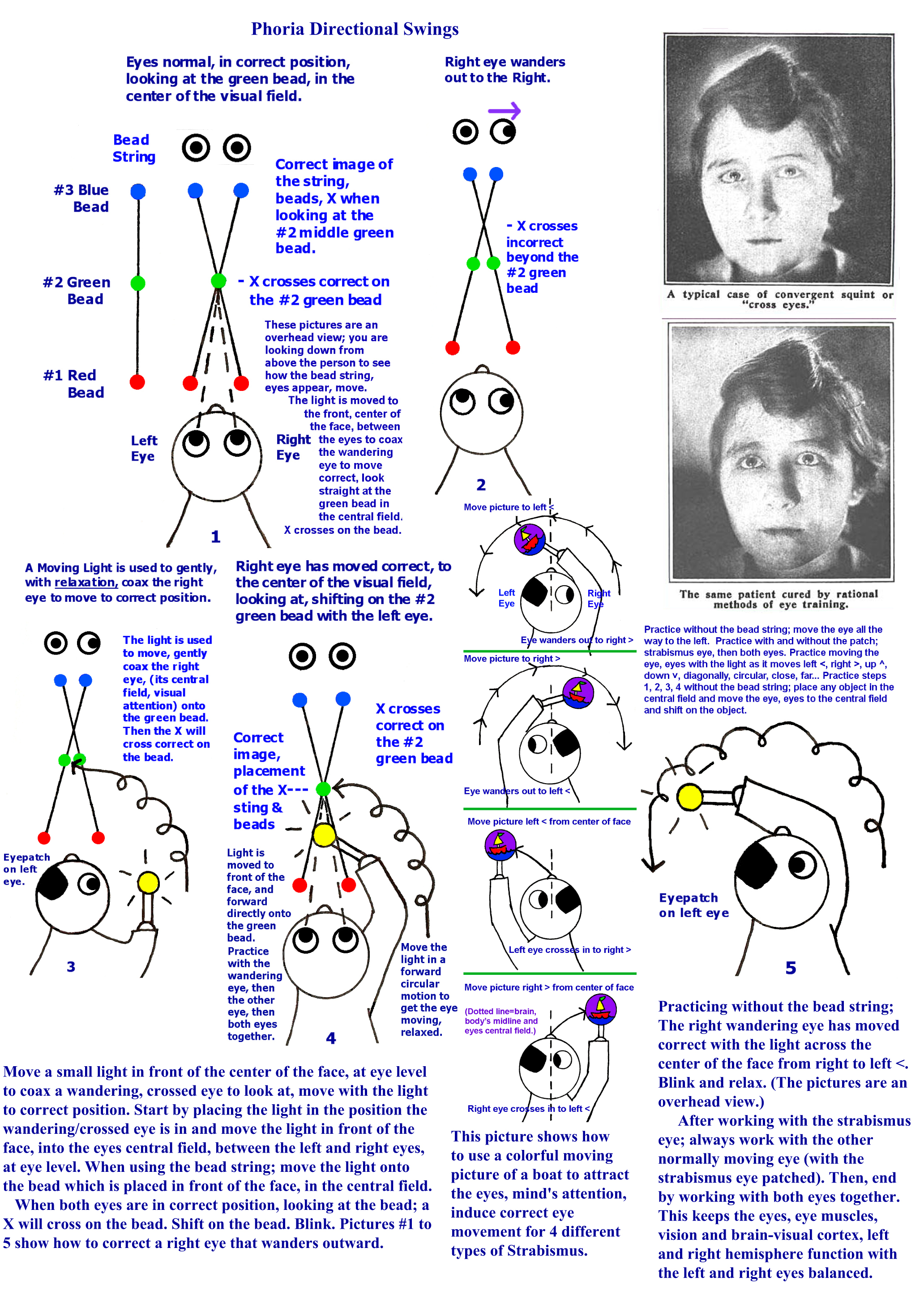Phoria Swing For Correct Eye Movement