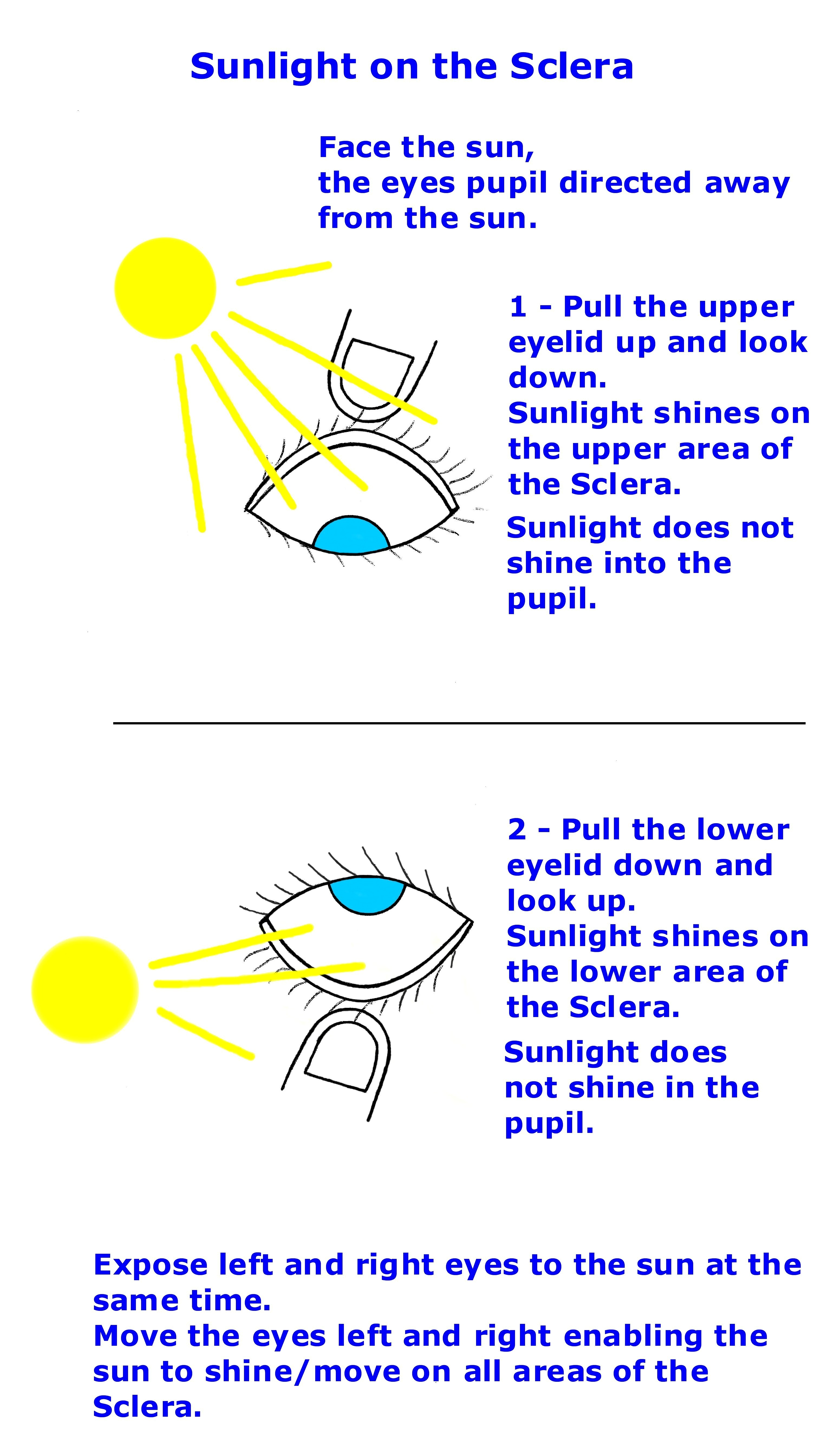 Sunlight_treatment.jpg Sunlight_treatment.jpg